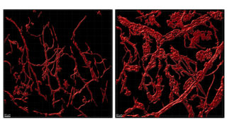 Blood vessels from normal mouse ear skin on the left and from a mouse that has a mutation in its endothelial cells on the right, showing endothelial cells expressing a red fluorescent marker, taken with the Nikon AX R MP microscope.