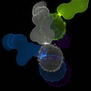 Temporal color-code image of F-actin in a melanoma cell undergoing fast amoeboid (leader bleb-based) migration