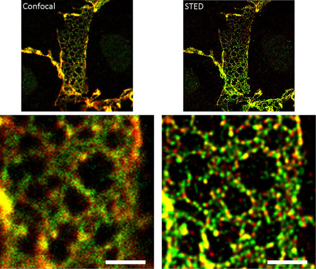 The endothelial adherens junction structure