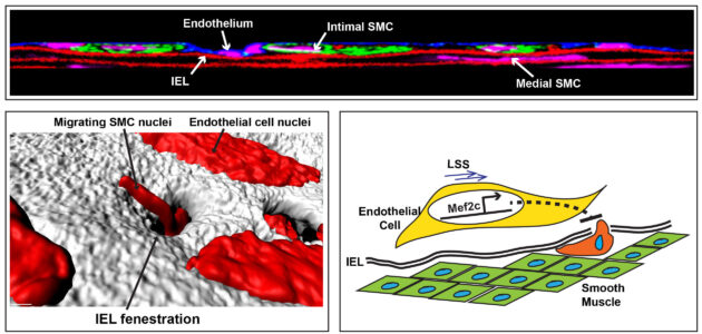 Image scan showing migrating SMC nuclei in muscle cells