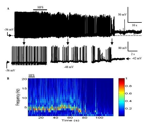 A series of graphs showing voltage of Deep Brain Stimulation over time.