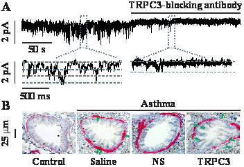 Immunohistochemistry staining α-smooth muscle actin (pink) and Ki67 (brown) in airways from control and asthmatic mice untreated and treated with saline, lentiviral SM22α promoter-driven non-silencing (NS) shRNA or TRPC3 channel shRNA in vivo.