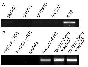 PAI-1 protein expression in human patients