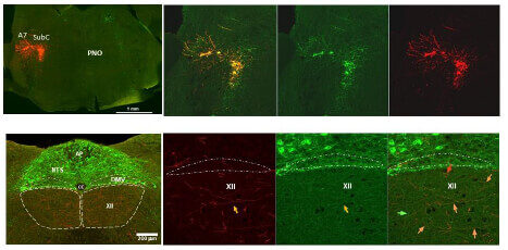 Microscopic images of chronic intermittent hypoxia (CIH), a major pathogenic factor of OSA, on noradrenergic innervation of XII motor motoneurons